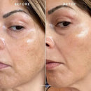 True Botanicals-Phyto-Retinol Vitamin A Booster Facial Serum-Fine Lines & Wrinkl